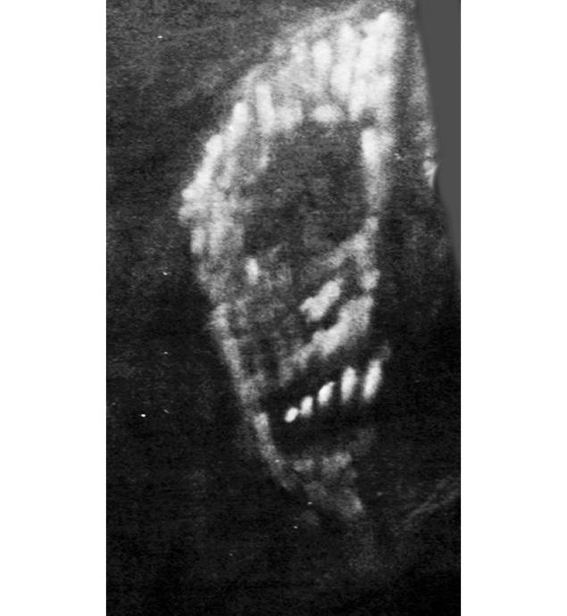 A skeletal face painted on a wall in James Gordon Wolcott’s room.